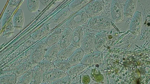 Peritrich Ciliate at 20x Under Nomarski DIC Microscopy Stock Footage 336944575