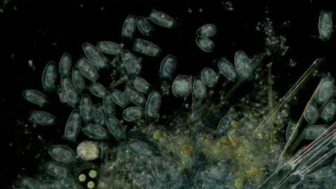 Peritrichia sp. Ciliate at 10x Under Darkfield Microscopy Stock Footage 335086248