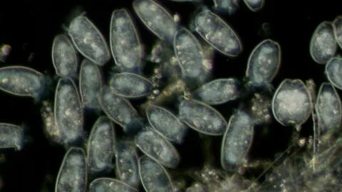 Peritrichia sp. Ciliate at 20x Under Darkfield Microscopy Stock Footage 335086247