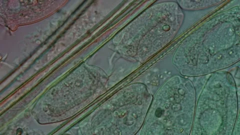 Peritrichia sp. Ciliate at 50x Under DIC Microscopy, Scientific Footage Stock Footage 335086236