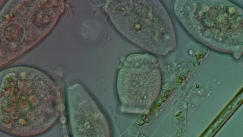 Peritrichia sp. Ciliate Close-Up at 50x Under DIC Microscopy Stock Footage 335086308