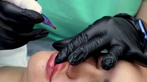 Permanent lip makeup procedure Stock Footage 194562992