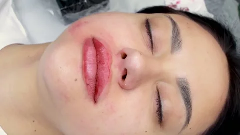 Permanent lip makeup procedure Stock Footage 194563478