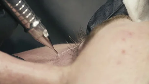 Permanent make-up of dark circles under the eyes Stock-Footage 79637395