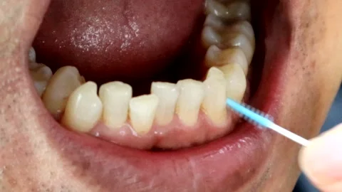 A person cleaning between teeth Stock Footage 335606596