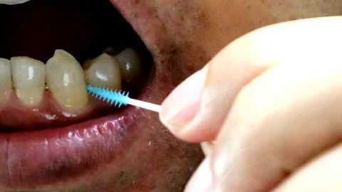 A person cleaning the gaps between their teeth with an interdental brush. Stock Footage 335607705