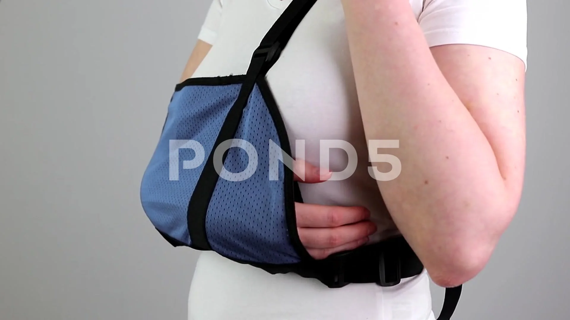 Top 147+ sling bag for hand fracture - 3tdesign.edu.vn