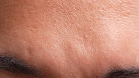 A person furrows their brows intensely. Stock Footage 317075972