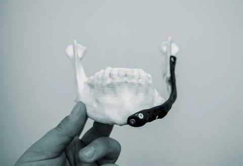 Person holds in hand an example of artificial jaw printed on 3D printer Stock Photos