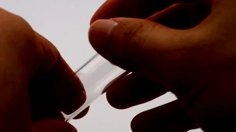 Person opening the urine sample container 動画素材 335935892