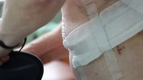 A person with a operation wound bundle things in a bag 스톡 동영상 82246705