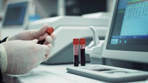 Person Performing Blood Sample Analysis Stock Footage 313439073
