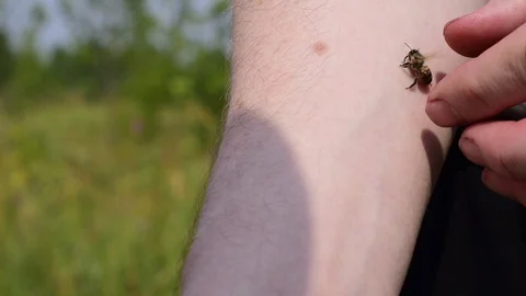 The person removes bee, which stung his hand Stock Footage 92308563