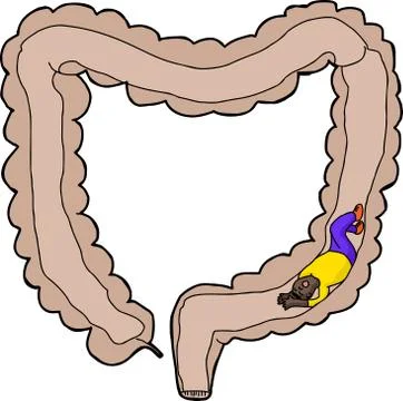 Person stuck inside intestine Stock Illustration