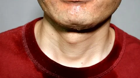 A person sweating profusely Stock Footage 329335705