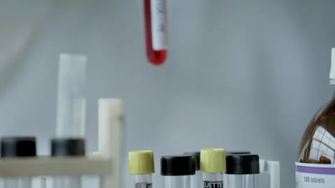 Person taking a blood sample labeled covid-19 Stock Footage 275251516