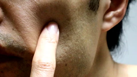 Person touching skin Stock Footage 335373398