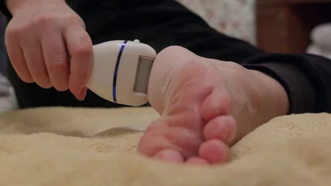 Person using electro pilling device on infant feet with original sound Stock Footage 341559035