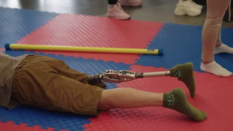 Person using a prosthetic leg during a rehabilitation session on a colorful mat Stock Footage 345147358