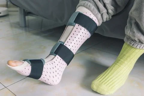 Persons lower leg fitted with a light pink perforated medical brace for injury Stock Photos
