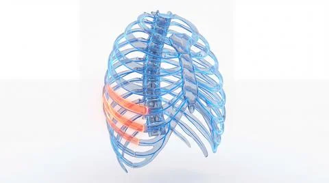 Perspective view of transparent human rib cage with glowing internal injury.. Stock Illustration