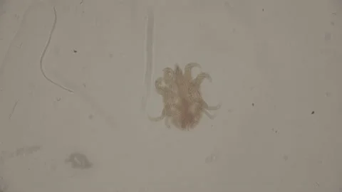 Pest Bug Under Microscope 4K Super Magnification 库存影片 238378466