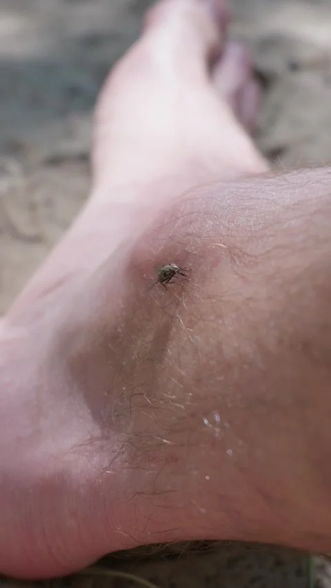 Pest Fly Biting on Bare Human Leg Skin in Outdoor Environment 스톡 동영상 342769236