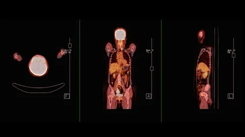 Whole Human Stock Videos – Royalty-Free HD & 4K Videos