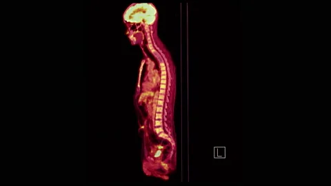 Whole Human Stock Videos – Royalty-Free HD & 4K Videos