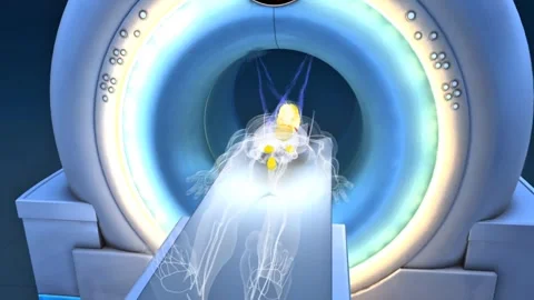 PET-CT Imaging Stock Footage 316778982