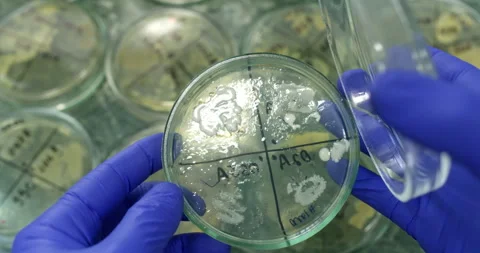 Petri dish with bacteria Stock Footage 308246806
