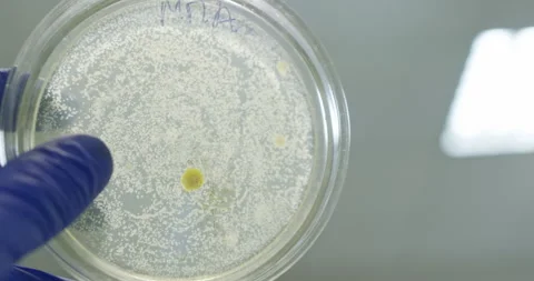 Petri dish with bacterial colonies Stock Footage 308246787
