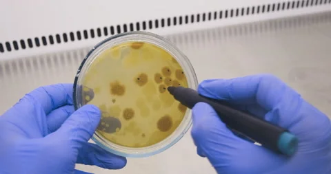 Petri dish with colonies of bacteria Vídeos de archivo 172189737