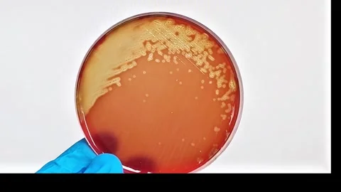 Petri dish with colony of hemolytic Streptococcus bacteria on blood agar medium Video stock 337723114