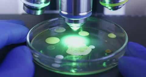 A petri dish containing bacteria. Stock Footage 310517910