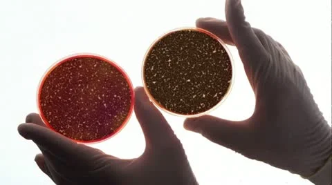 Petri dish Video stock 11351853