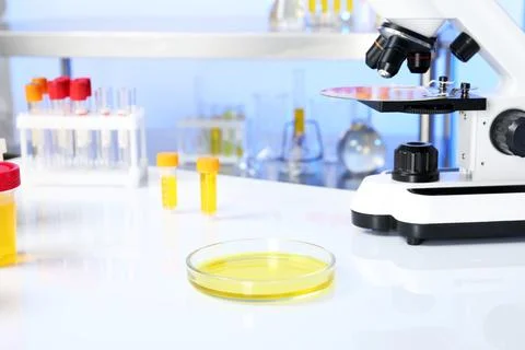Petri dish with urine sample for analysis and microscope on table in laborato Stock Photos