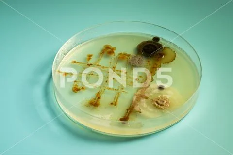 	petri dish with various bacteria colonies on agar Stock Photos