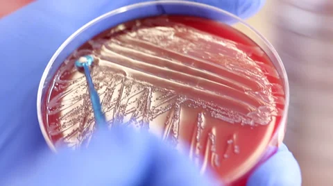 Petri dishes in the bacteriological laboratory 動画素材 31548934