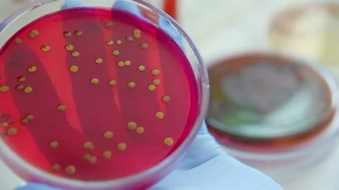 Petri dishes in the bacteriological laboratory Stock Footage 100520447