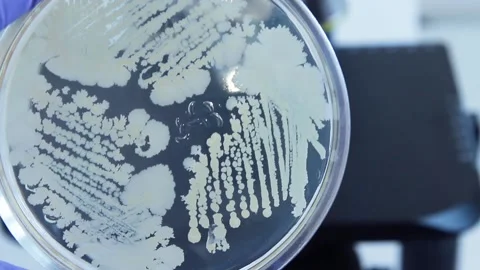 Petri dishes Stock Footage 96082729