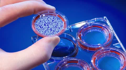 Petri2 Video stock 11431232