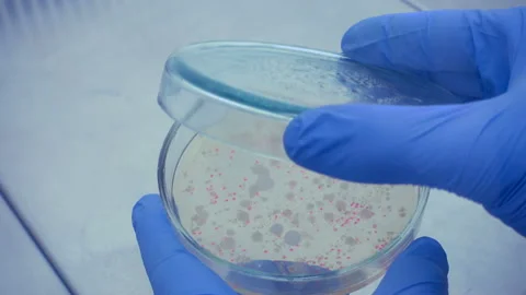 PetryDish open Stock Footage 108743380