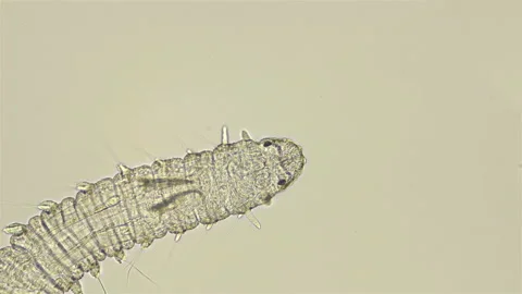 Phalacrophorus pictus worm under a microscope, family Iospilidae, class Stock Footage 125525624