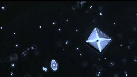 Phase contrast microscopic footage showing urine calcium oxalate crystal Video stock 273955266