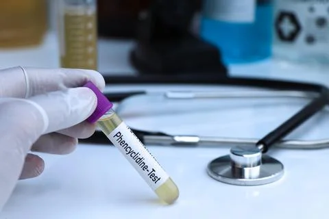 Phencyclidine test to look for abnormalities from Urine Stock Photos