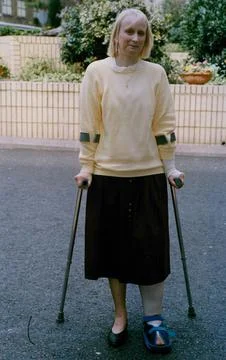 Phillippa Bradley Osteoporosis Sufferer. (for Full Caption See Version) Box 725  Stock Photos