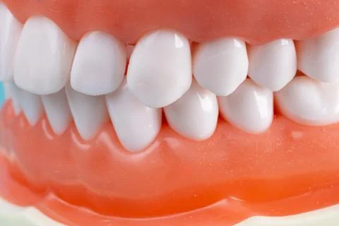 Photo of a set of false teeth with white teeth. Stock Photos