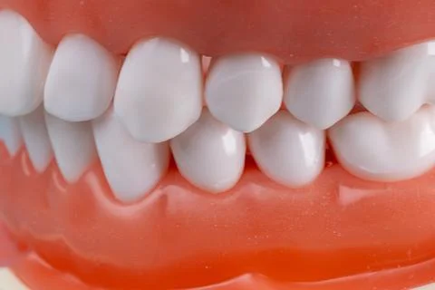 Photo of a set of false teeth with white teeth. Stock Photos