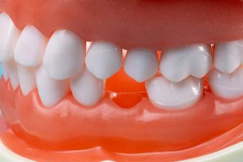Photo of a set of false teeth with white teeth. Stock Photos